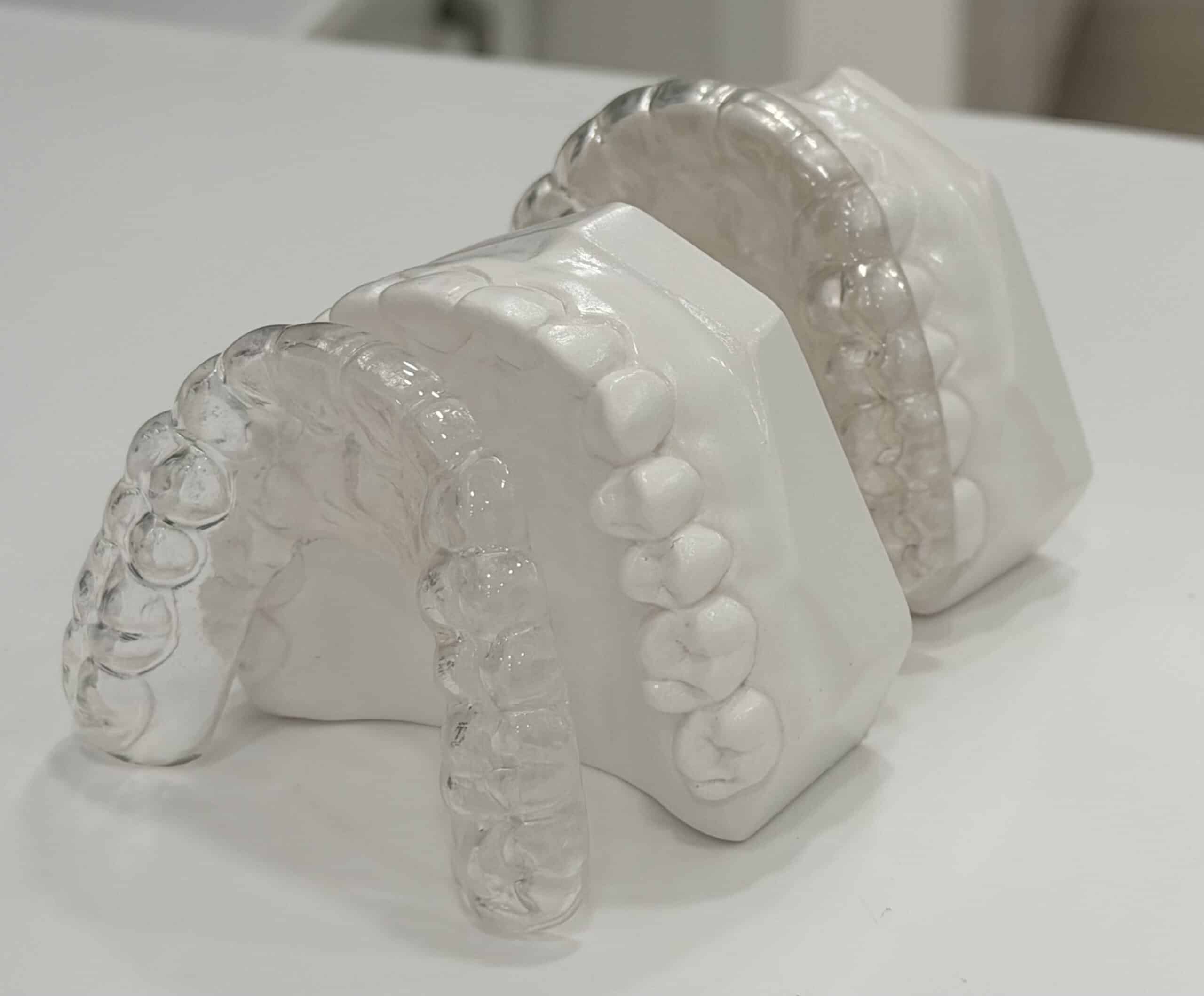 Clear Retainers Pristine Smiles in Orlando, FL